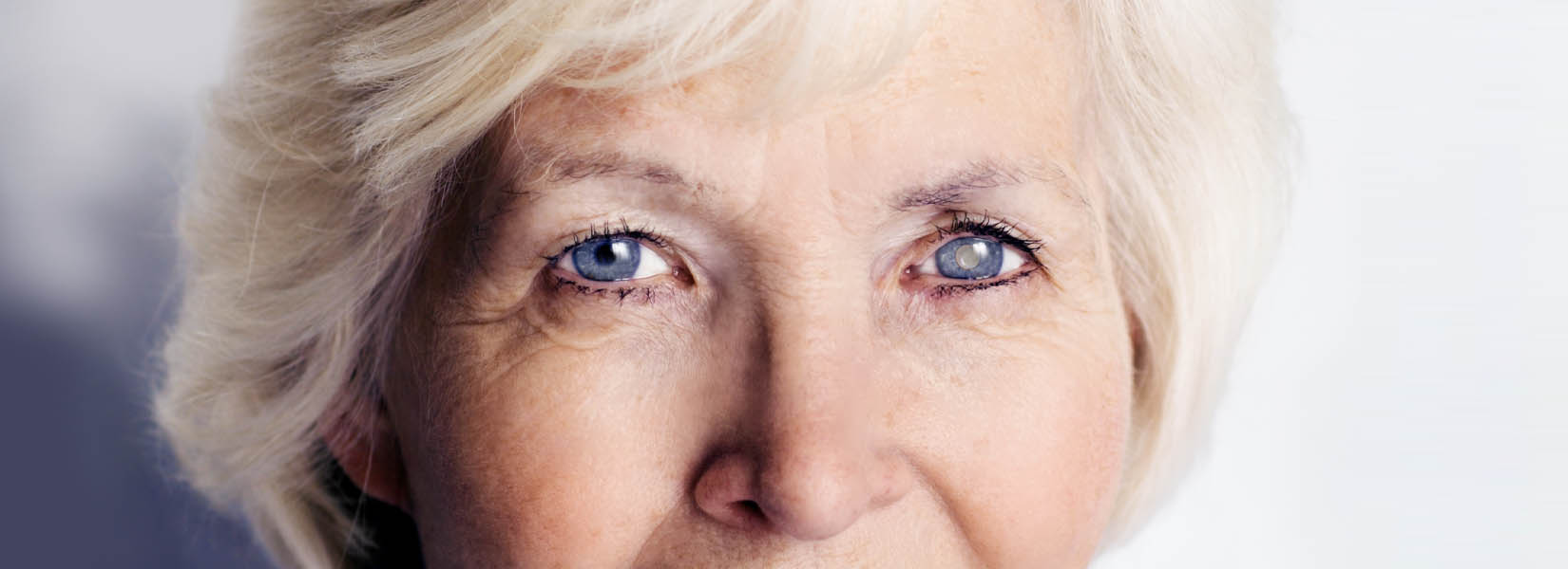 Cataract Surgery in Barrington